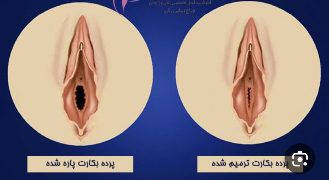 Screenshot_۲۰۲۶۰۶۲۴_۲۲۲۶۱۰_Google
