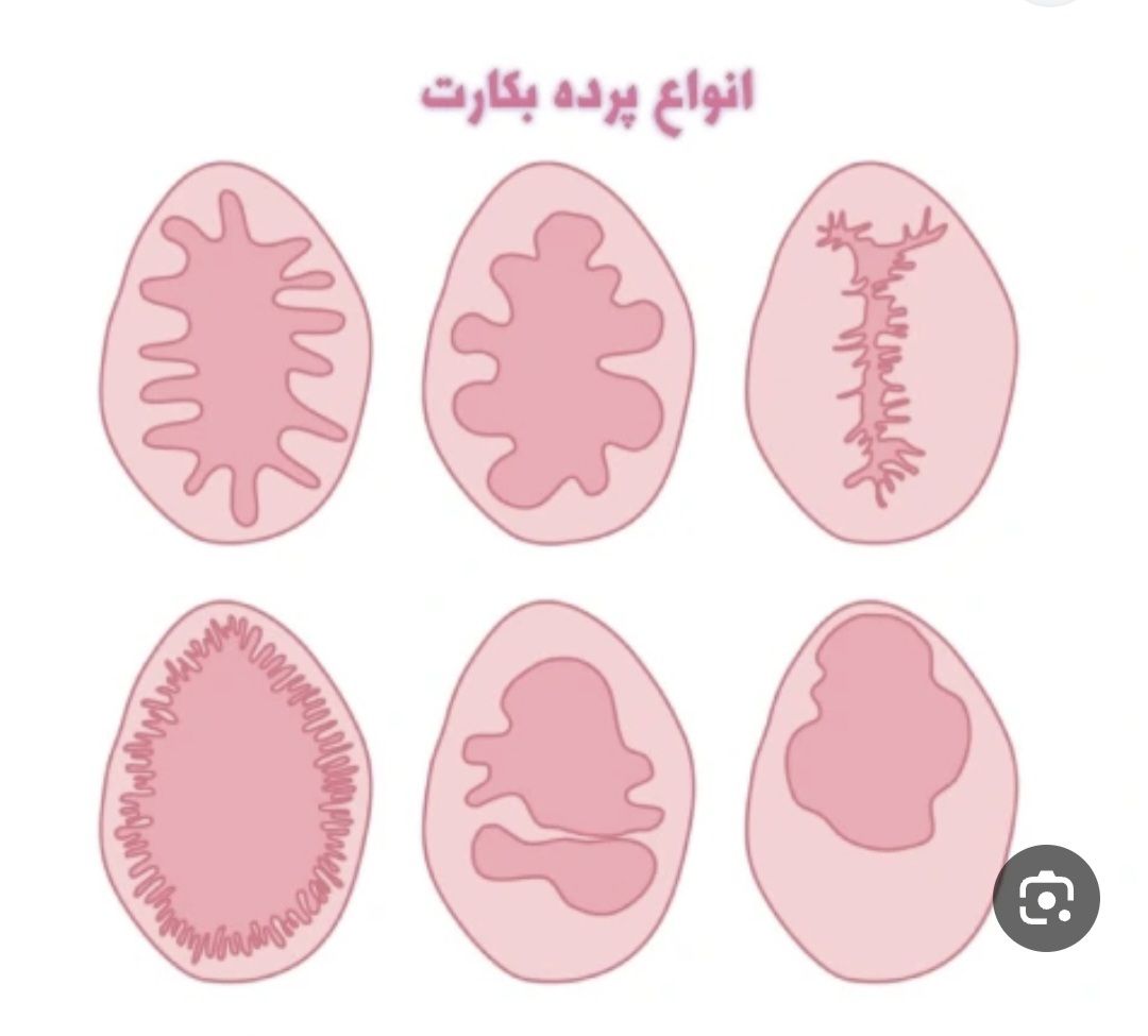 Screenshot_۲۰۲۶۱۰۲۰_۲۳۲۴۱۹_Google ترمیم پرده بکارت در نورآباد لرستان – مشاوره تخصصی و محرمانه